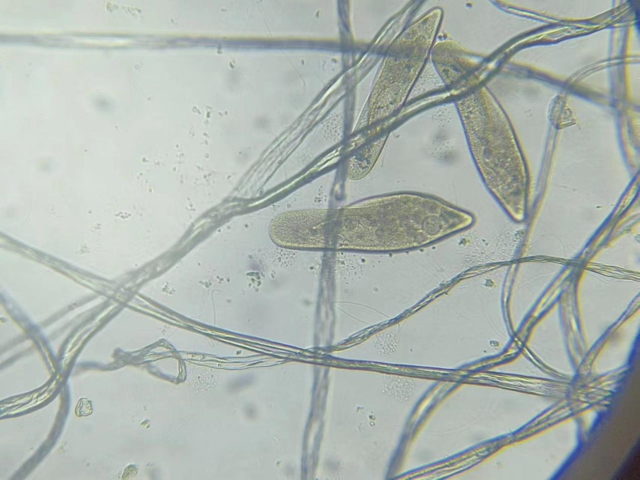 C:\Users\lenovo\Documents\WeChat Files\wxid_k395sqw5z8fd22\FileStorage\Temp\4991104227c975e2c80950fc61586e1.jpg